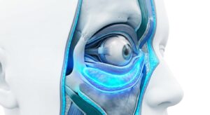 눈가 미세 볼륨 형성을 시각화한 3D 의학 일러스트